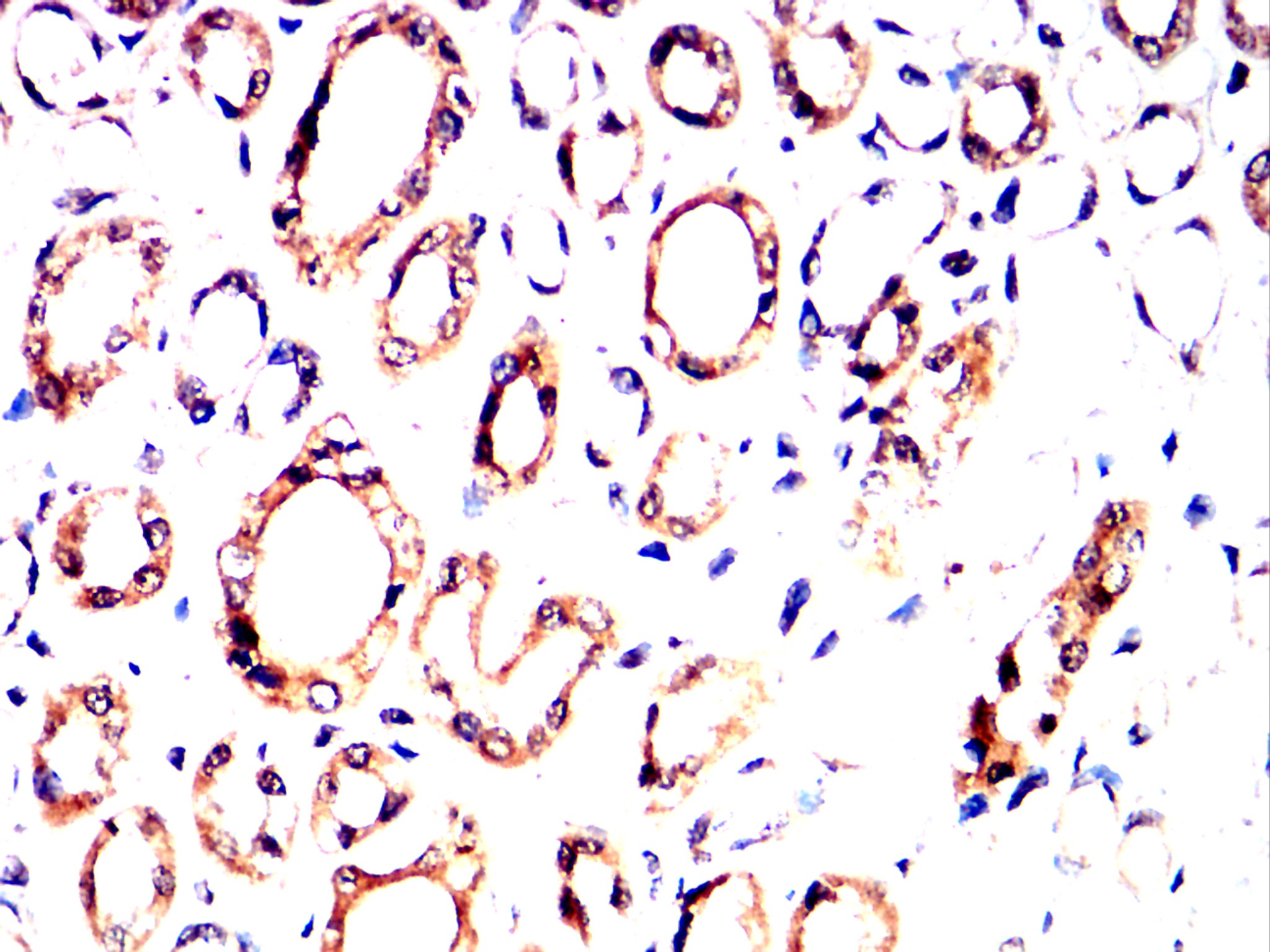 IHC